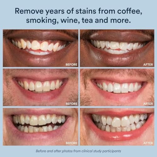 Mirova Teeth Whitener